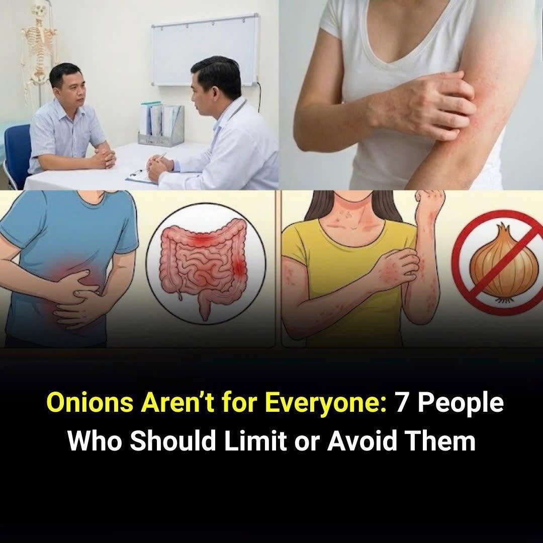 Not Everyone Should Eat Onions: Here’s Who Needs to Be Careful