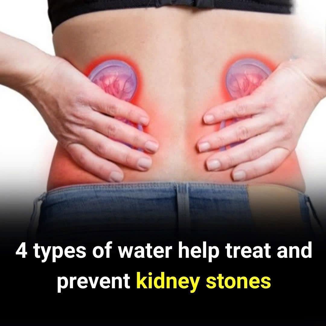 4 Simple Waters That May Help With Kidney Stones Naturally