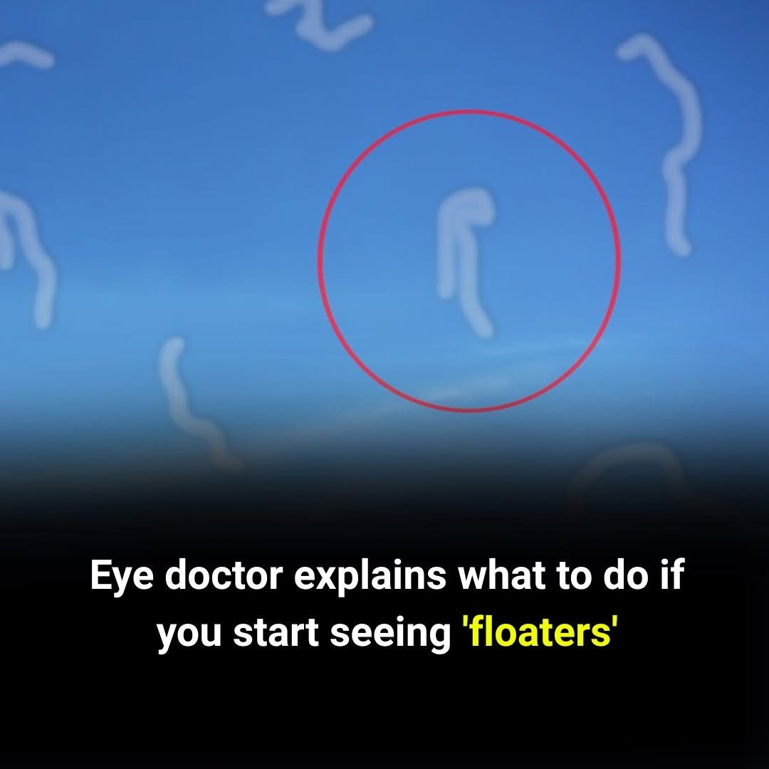 Most People Ignore Floaters—But Doctors Say You Should Pay Attention If They Appear Suddenly