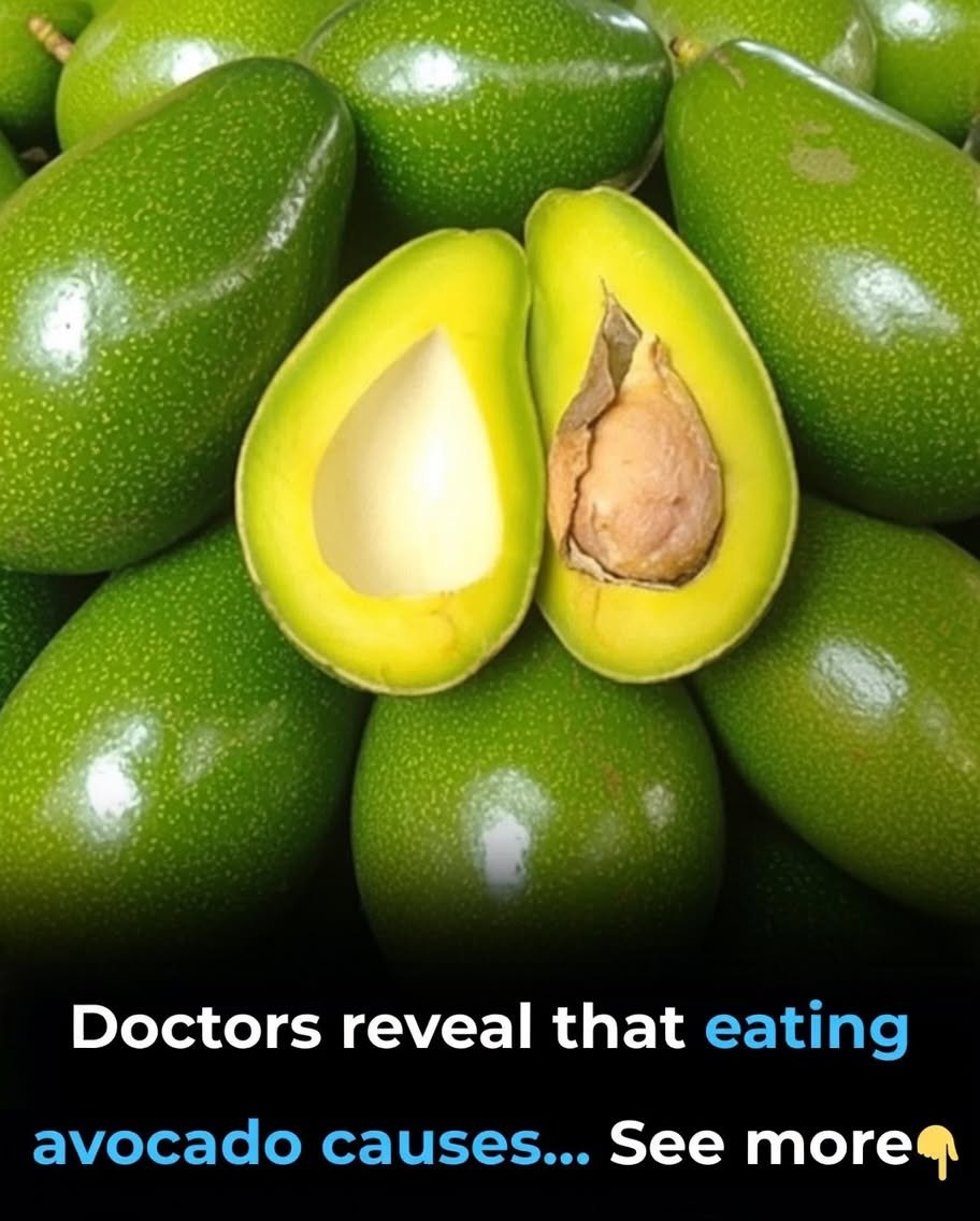 Think Avocados Are Just a Trend? You Might Be Missing What Experts Really Say