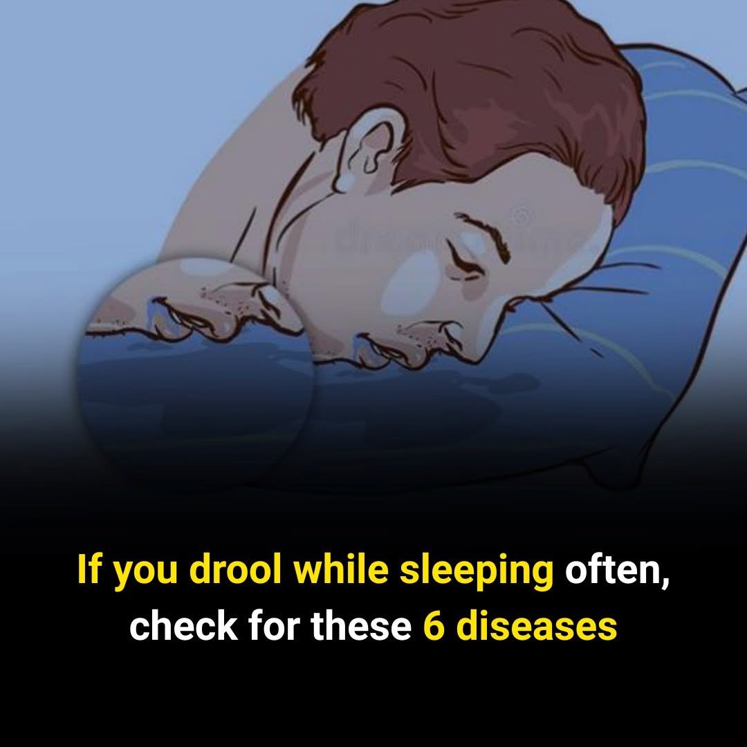 If You Often Wake Up With Drool, Pay Attention — Here’s What It Could Mean