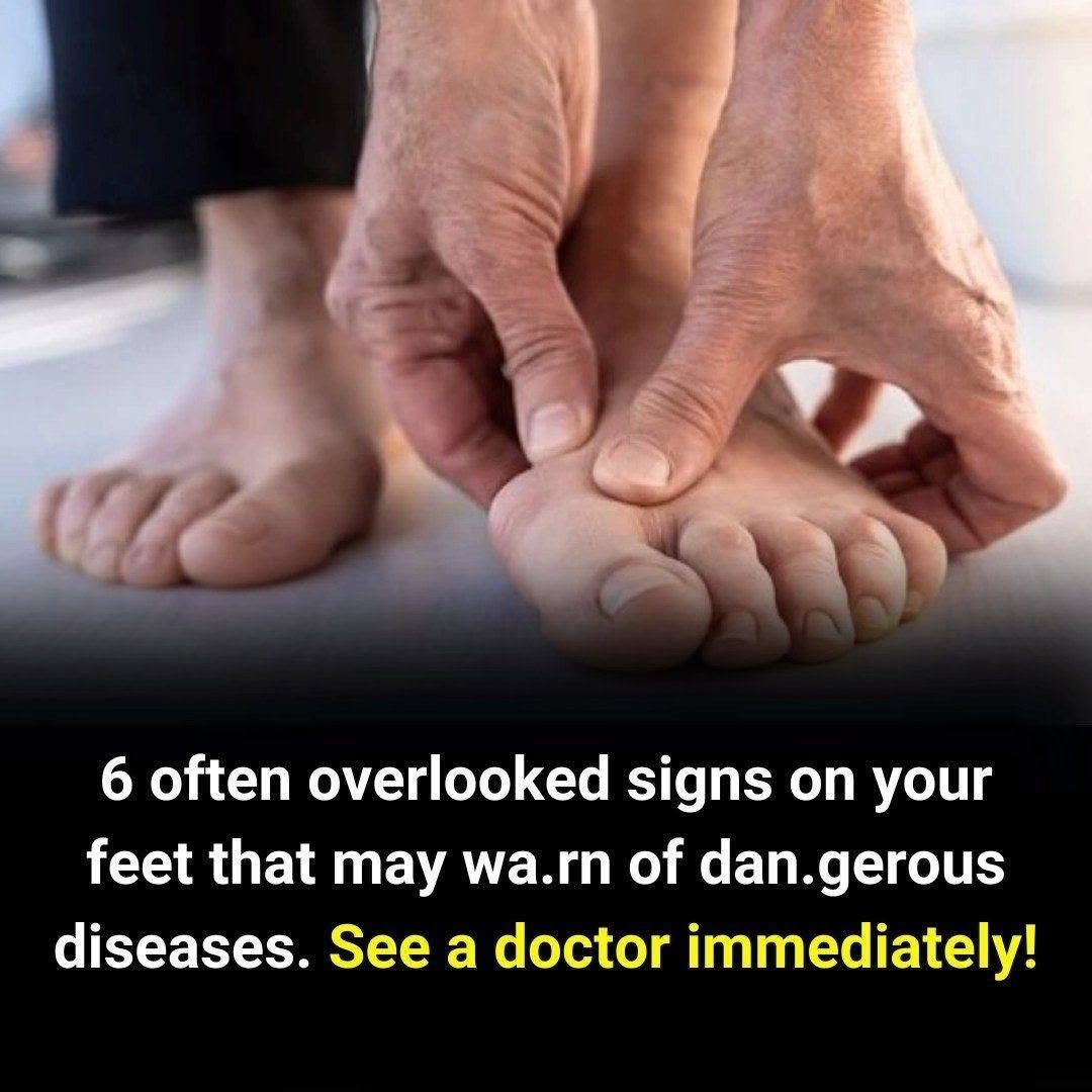 Cancer Signs Can Appear on the Feet — Here’s When to See a Doctor