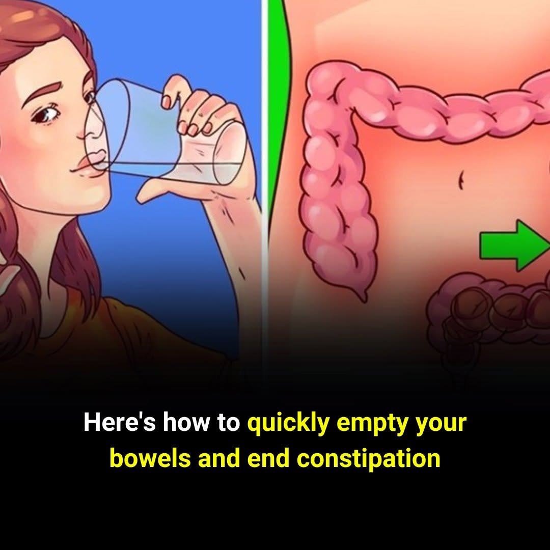 Looking for Constipation Relief? Try These Simple and Effective Home Solutions…