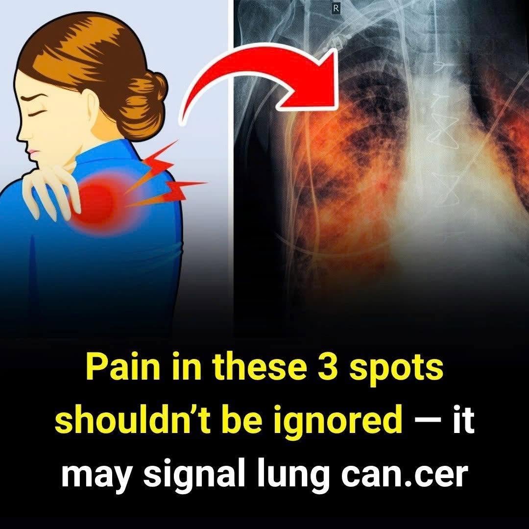 These 3 Types of Pain May Indicate Lung Cancer — Don’t Overlook Them