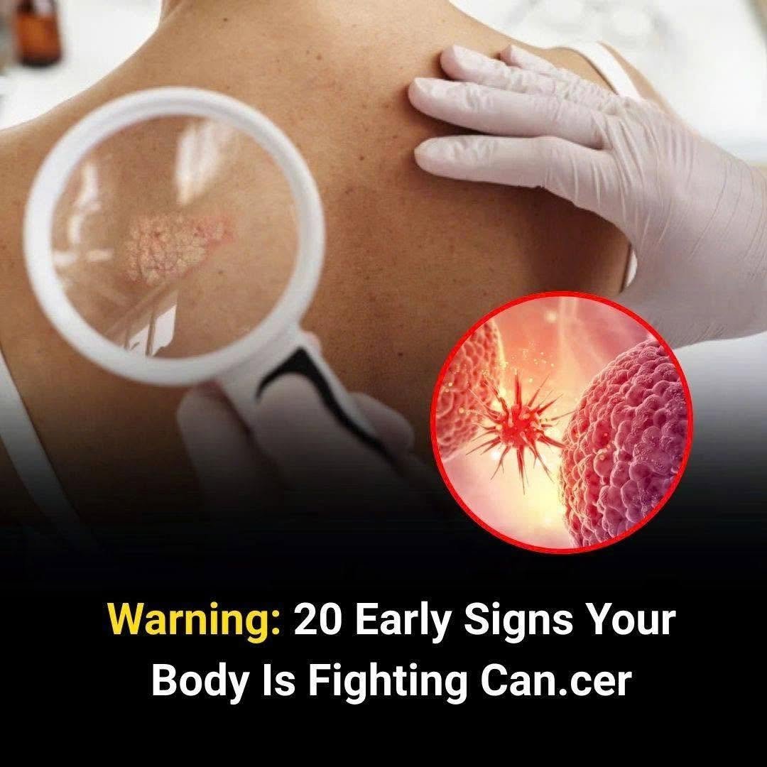 Don’t Ignore These 20 Early Warning Signs That Your Body Could Be Fighting Cancer