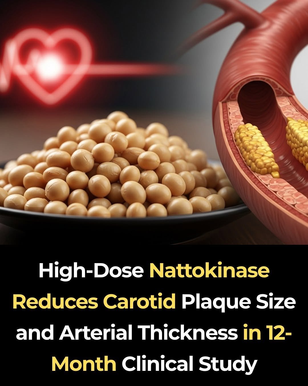 High-Dose Nattokinase Reduced Carotid Plaque in a 12-Month Study — But There’s More to the Story
