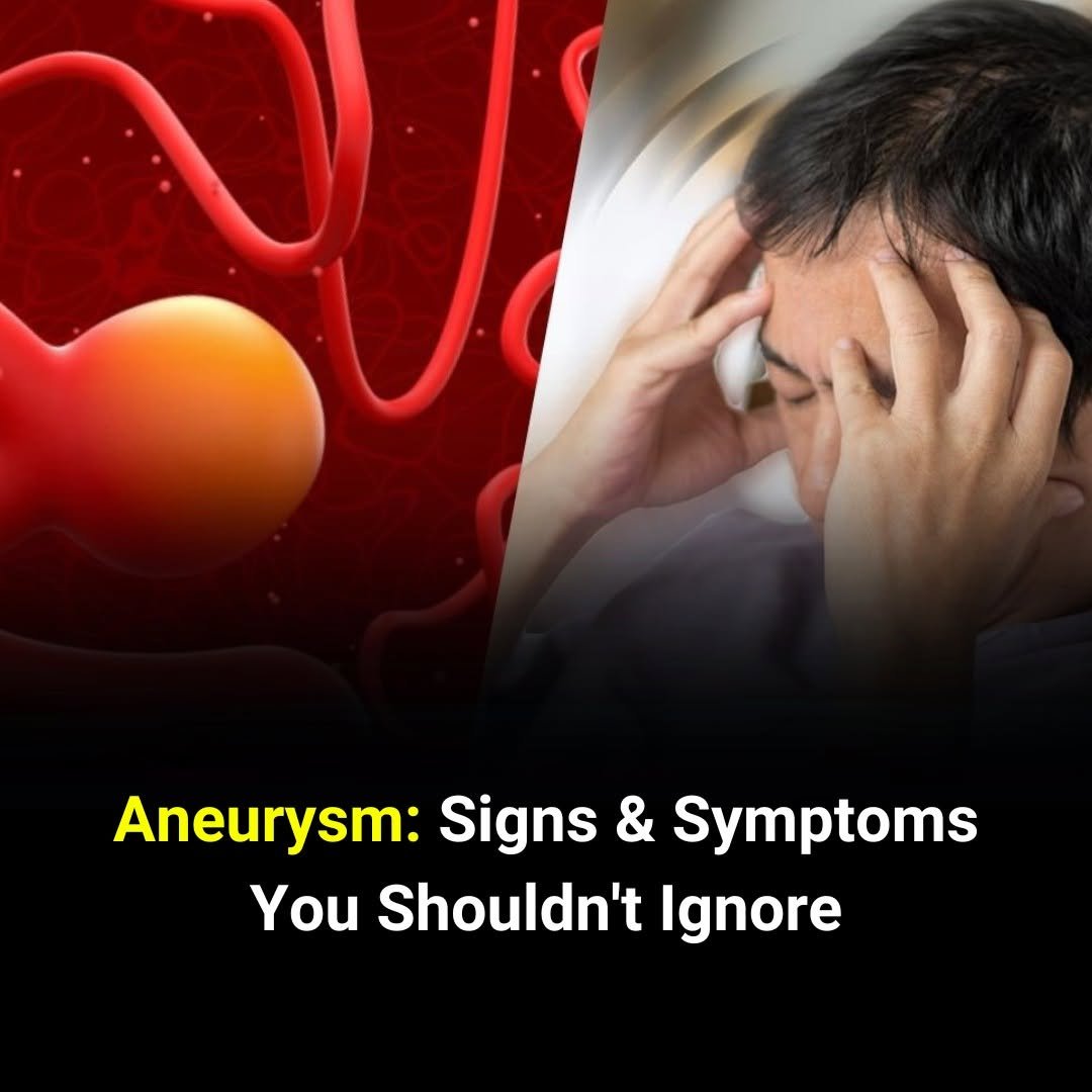 Doctors Say These Aneurysm Symptoms Require Immediate Attention