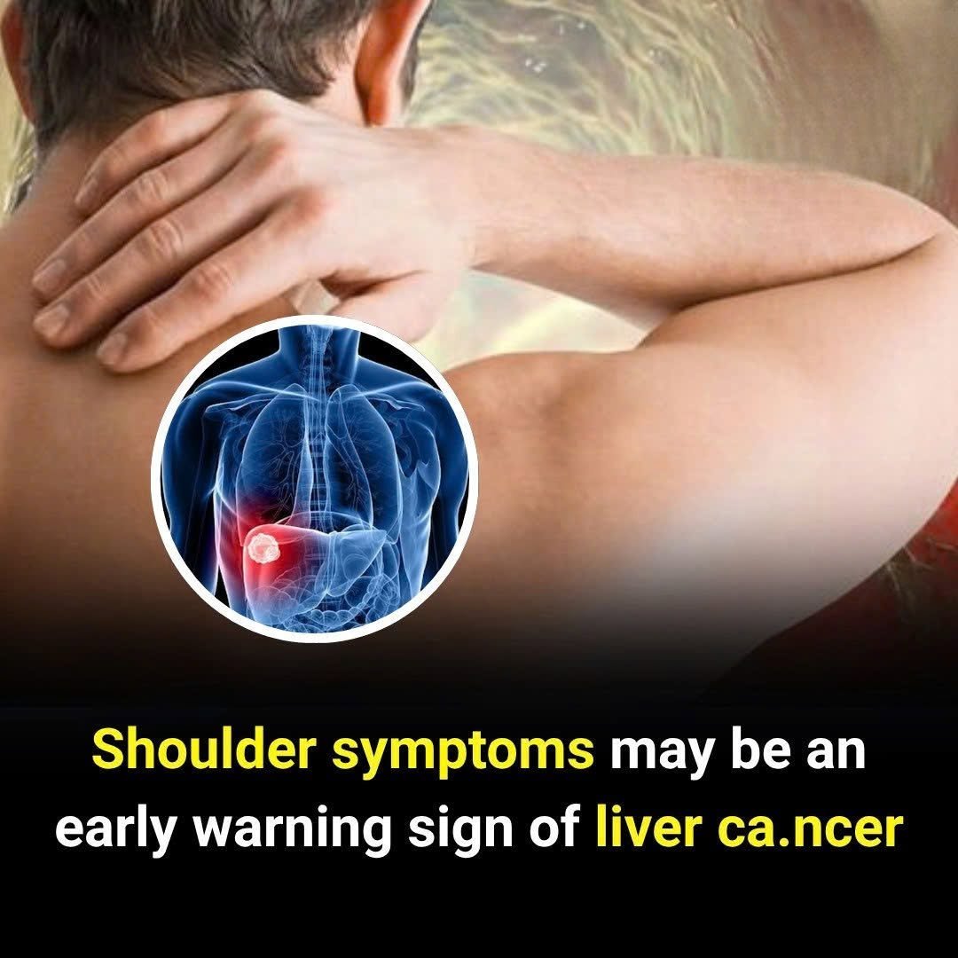 Could Shoulder Discomfort Be an Early Warning Sign of Liver Cancer?