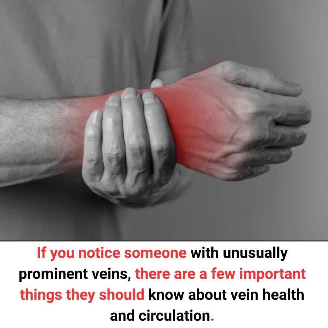 If You Notice Someone With Unusually Prominent Veins, Here’s What They Should Know About Vein Health