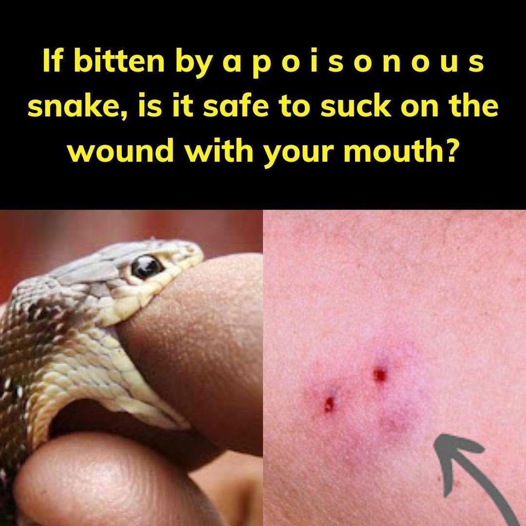 What to Do If You’re Bitten by a Snake