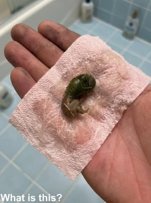 We Found This Strange Thing in Our Bathroom — What Could It Be?