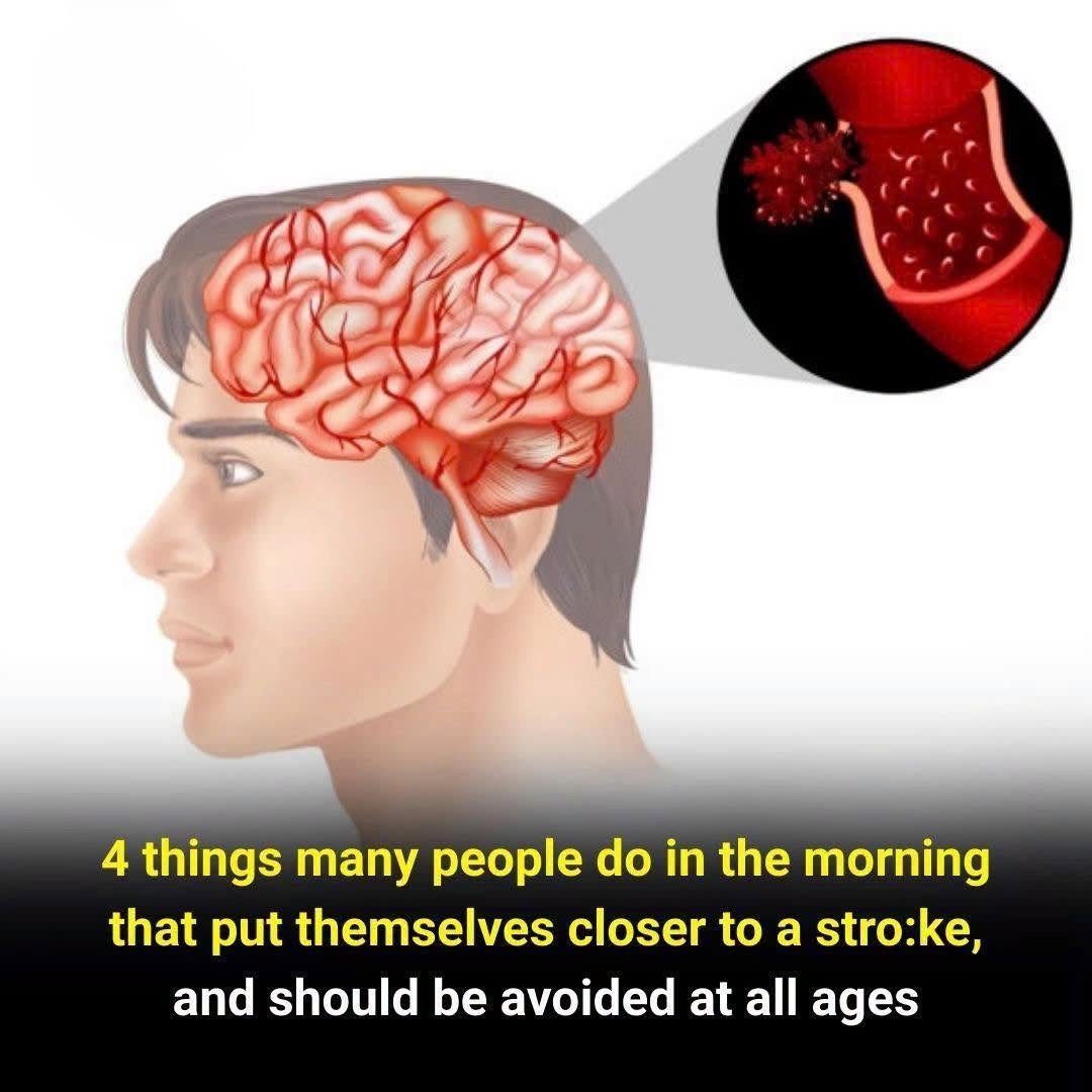 4 Morning Mistakes That Increase Stroke Risk — No Matter Your Age