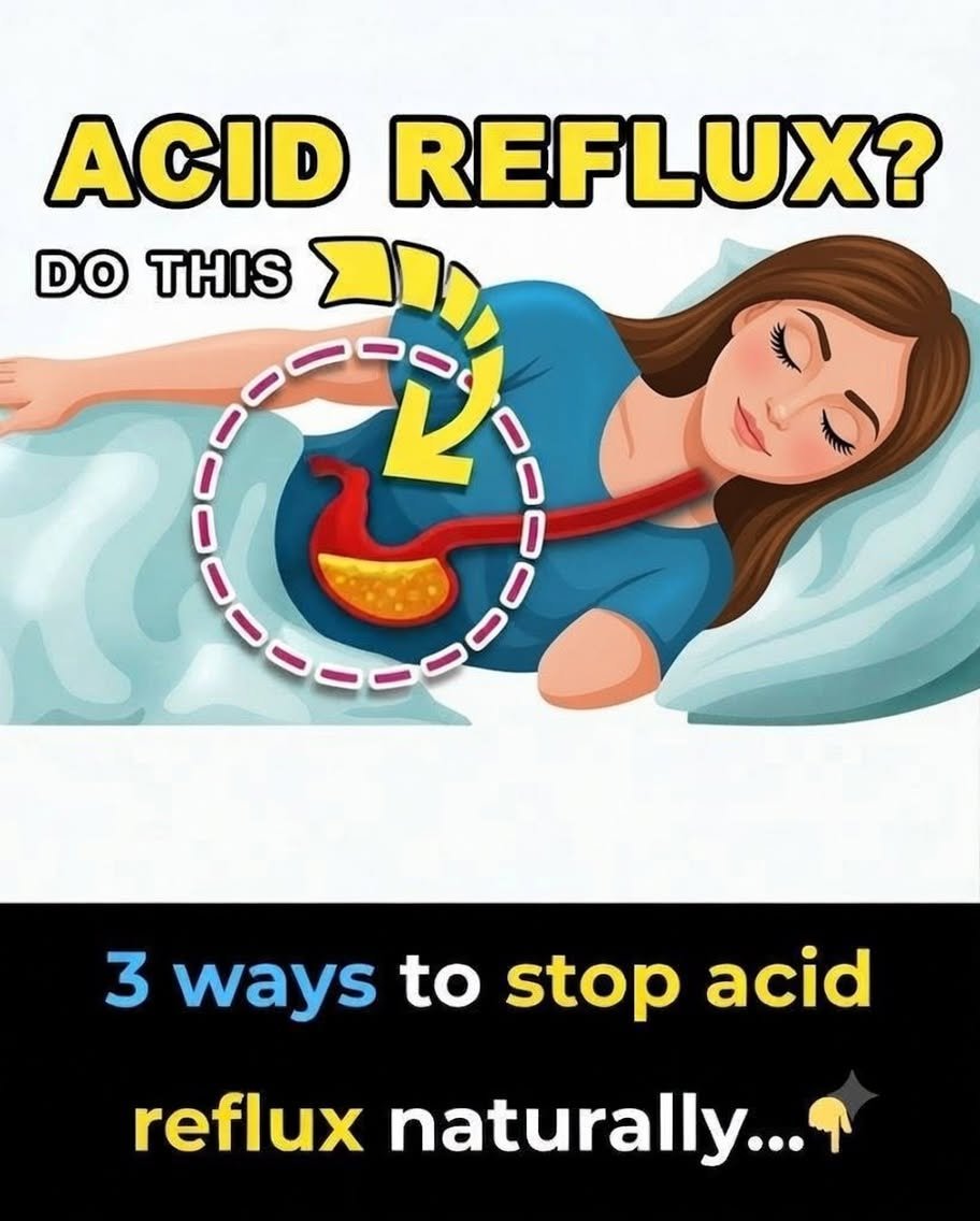 Acid Reflux Isn’t Always About Too Much Stomach Acid — Here’s What Experts Know