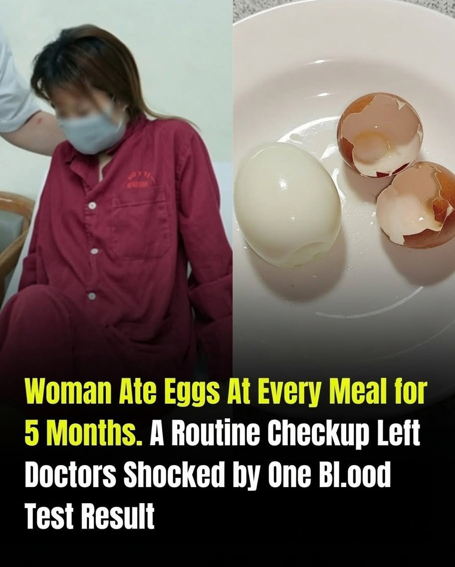 She Ate Eggs at Every Meal for 5 Months While Trying to Lose Weight — What Her Checkup Revealed