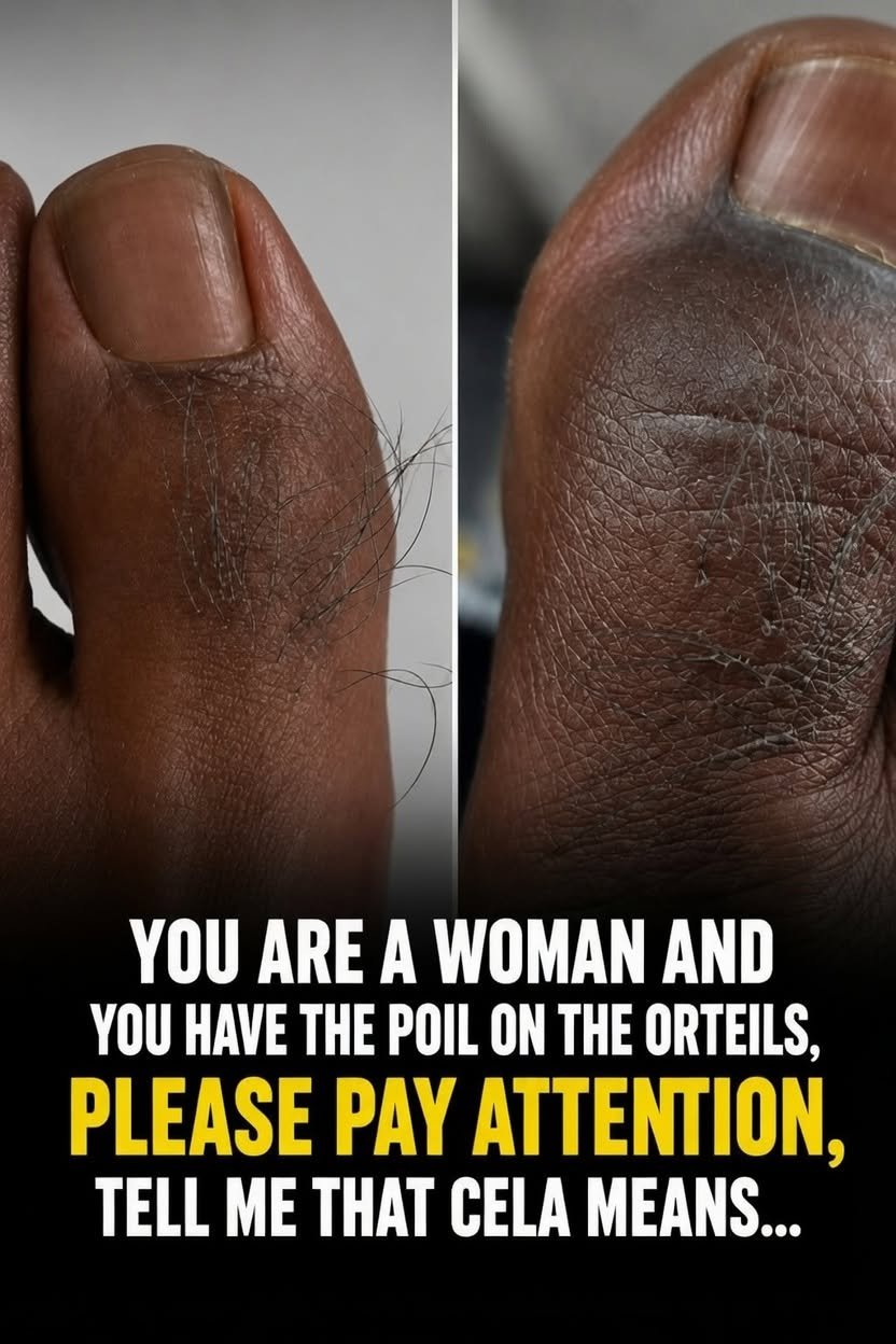 What Does Hair on Your Toes Say About Your Health? Many Women Are Surprised