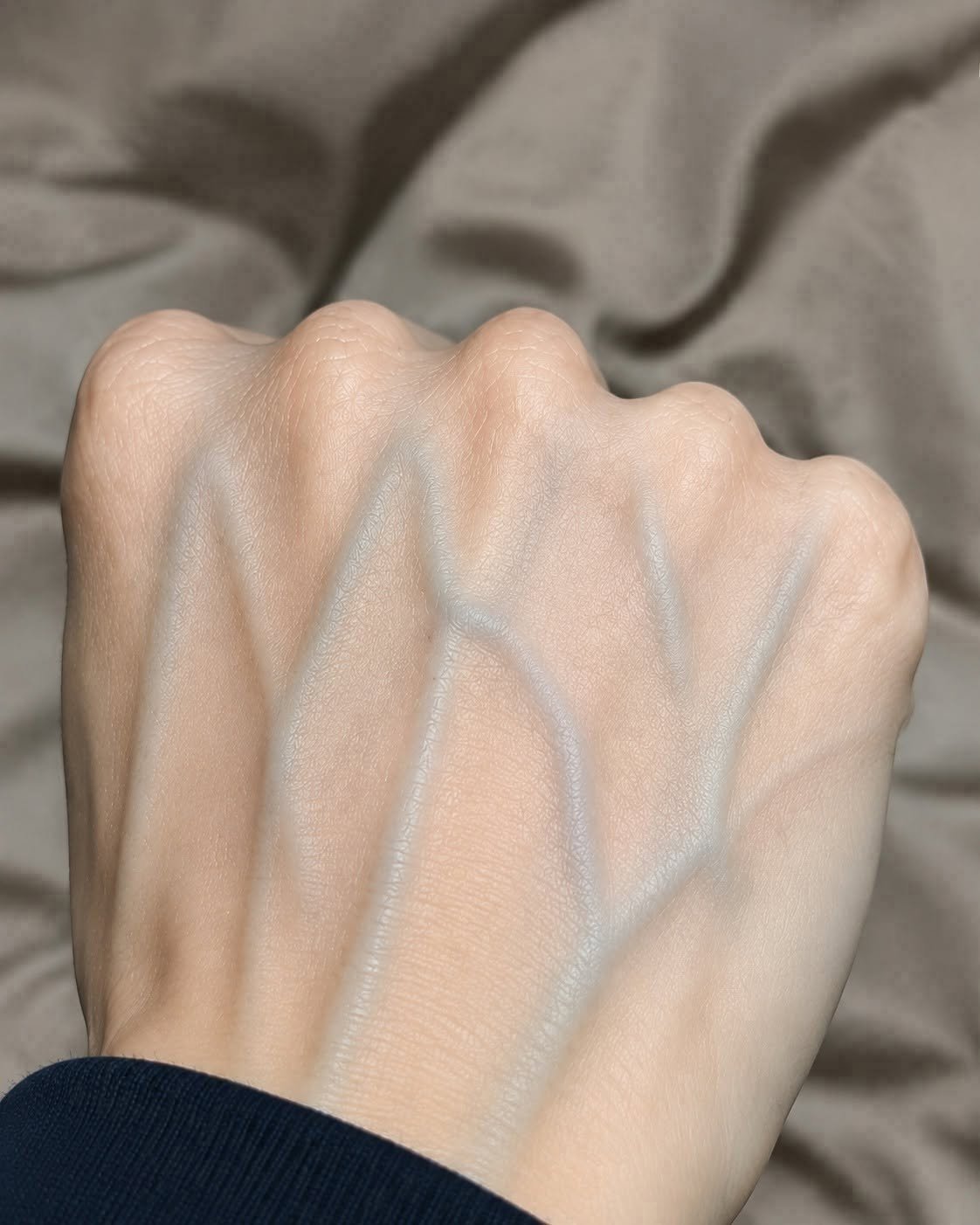 If Your Veins Are Visible, Here’s What It May Mean…