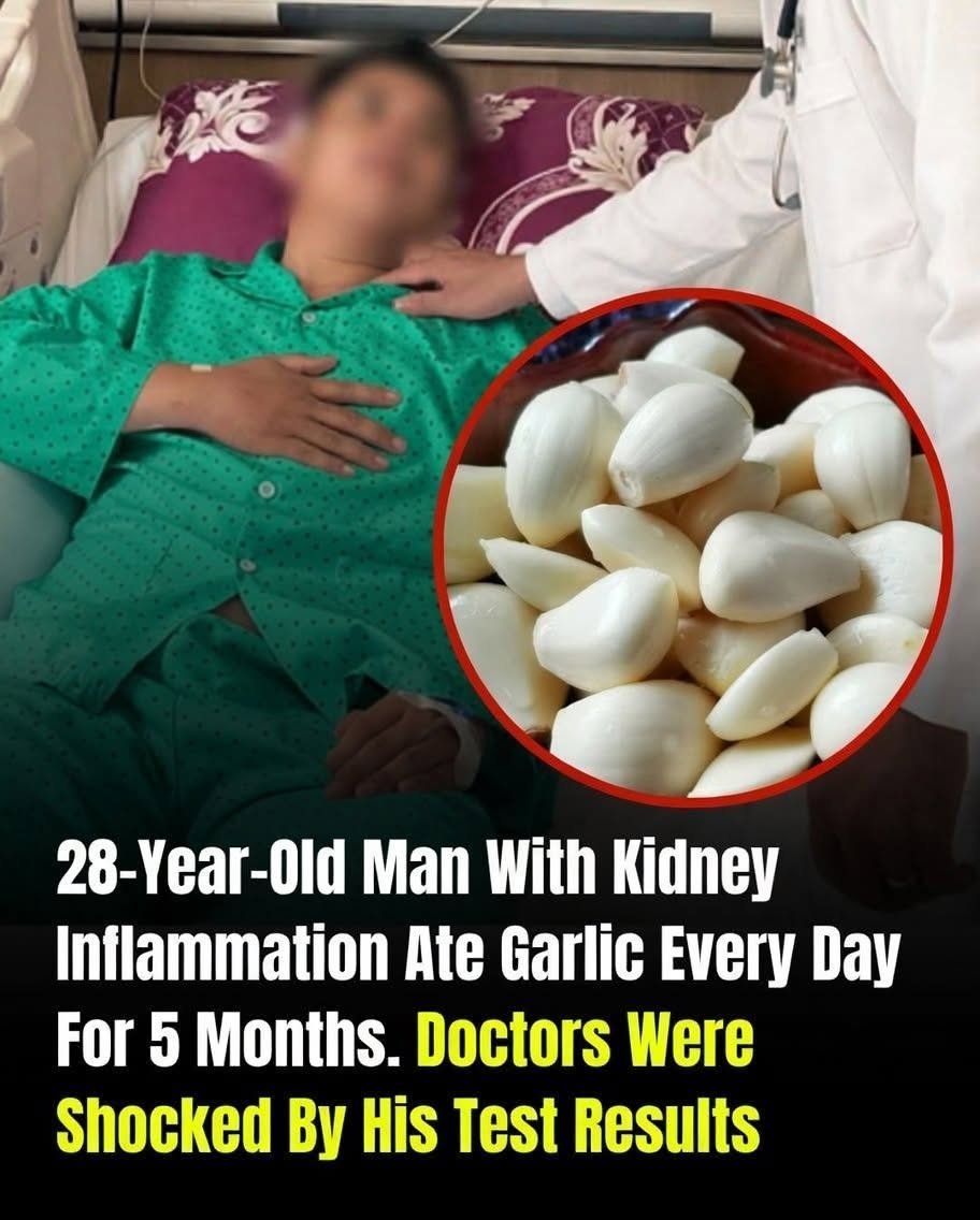 He Ate Garlic Every Day for 5 Months to “Heal” His Kidneys—What Does the Evidence Actually Say?