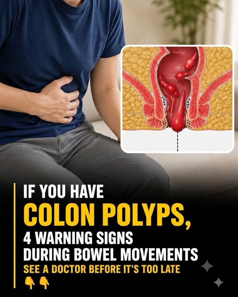 Doctors Warn: These 4 Bathroom Signs May Appear Before Colon Cancer