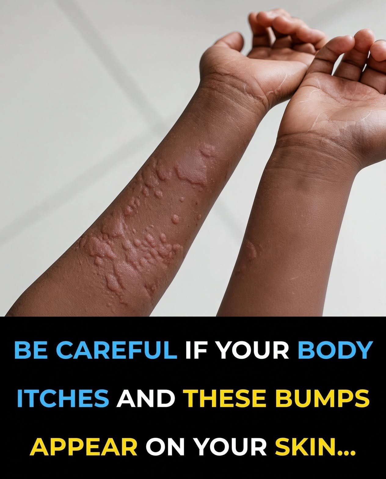 Itchy Skin and Unexpected Bumps Could Have Several Possible Causes