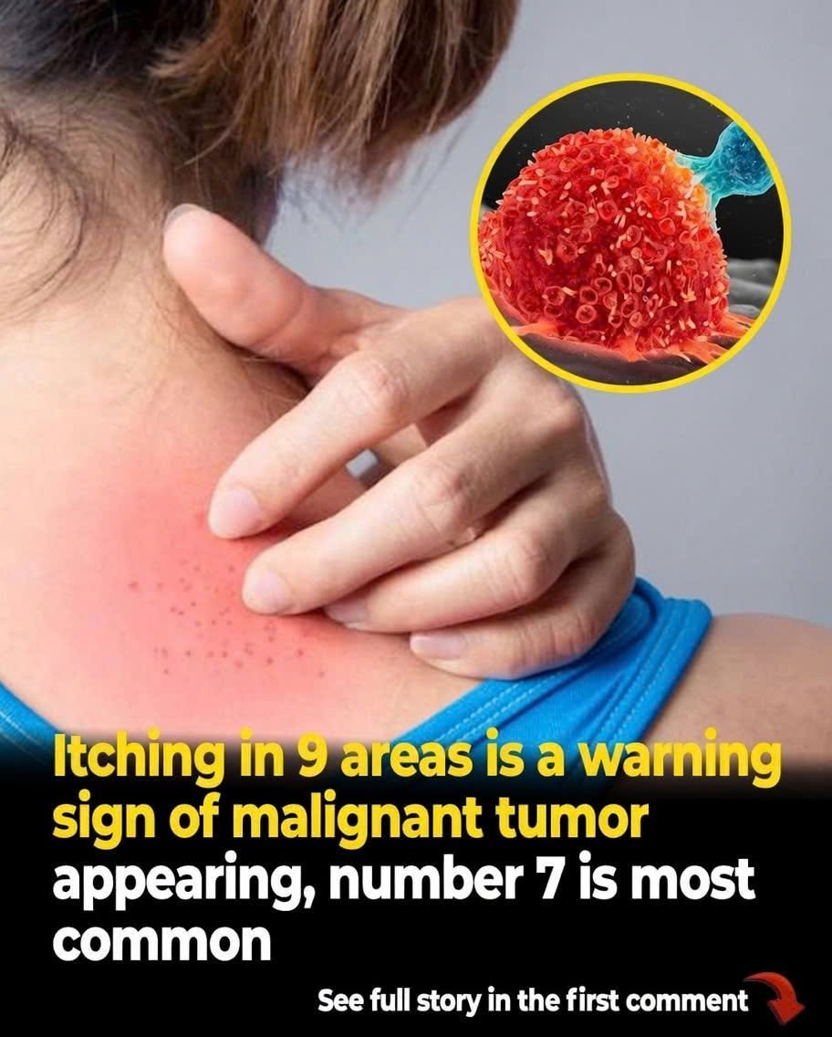 9 Unusual Itching Symptoms That Could Be Your Body’s Way of Signaling an Underlying Problem