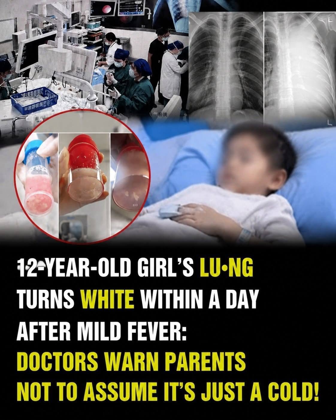This Frightening Case Shows How Quickly a Child’s Condition Can Deteriorate