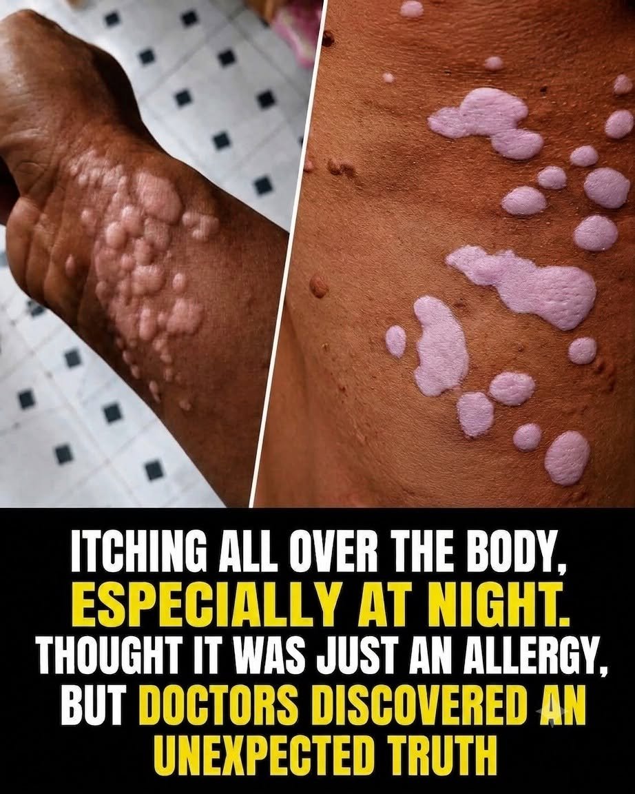 Thought It Was Just an Allergy, but Doctors Discovered an Unexpected Truth