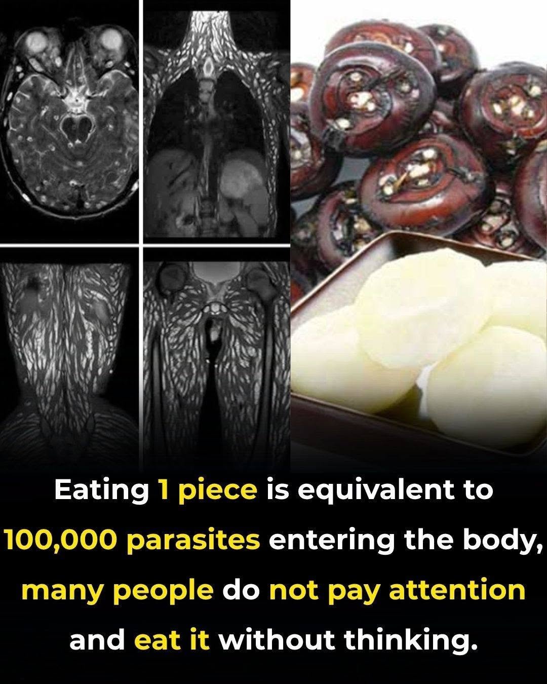 People Often Consume This Food Without Knowing It Could Contain Harmful Parasites