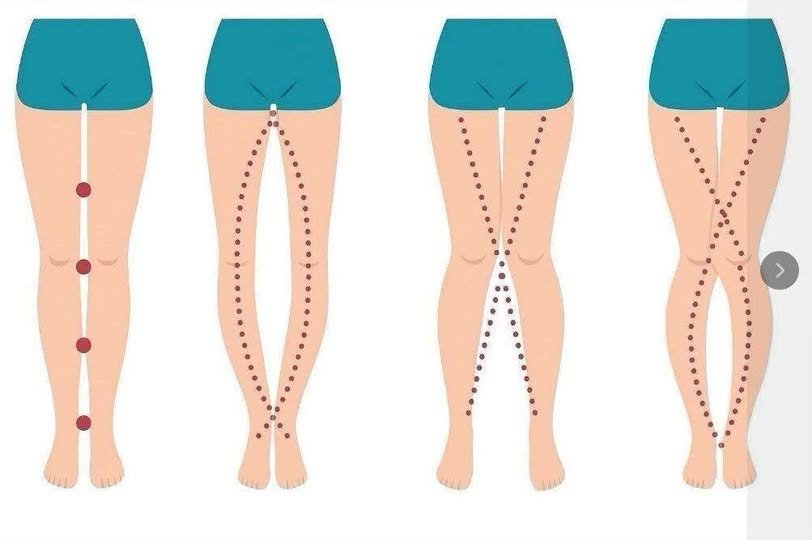 A Woman’s Legs Can Tell You More About Her Health Than You Might Think