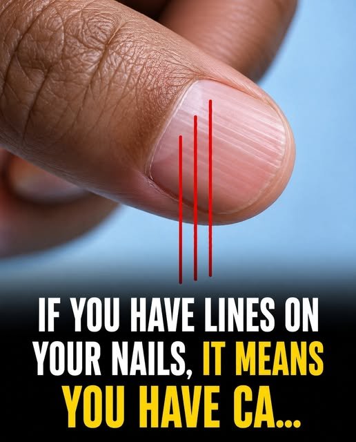 Those Lines on Your Nails May Not Be Random—Especially If You’re Over 40