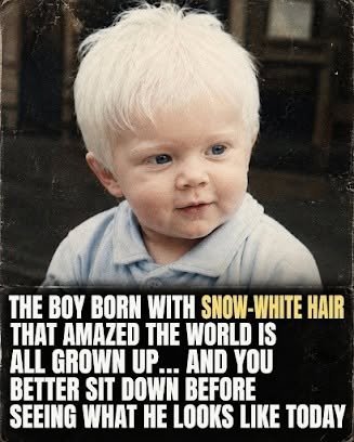 The Story Behind the Viral “Snow-White Hair” Baby