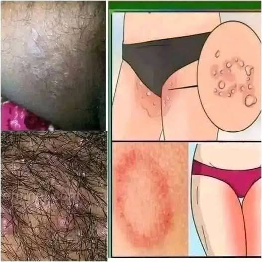 These Are the First Symptoms That It’s Growing: Recognizing Fungal Skin Infections