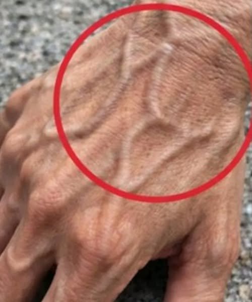 The Truth About Visible Veins: What They Really Mean for Your Health