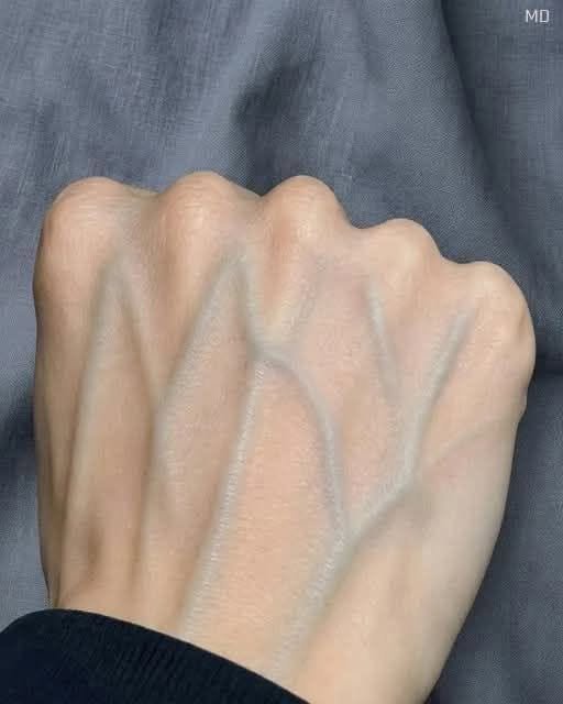 Debunking Viral Myths: Prominent Hand Veins vs. Sensational Health Claims
