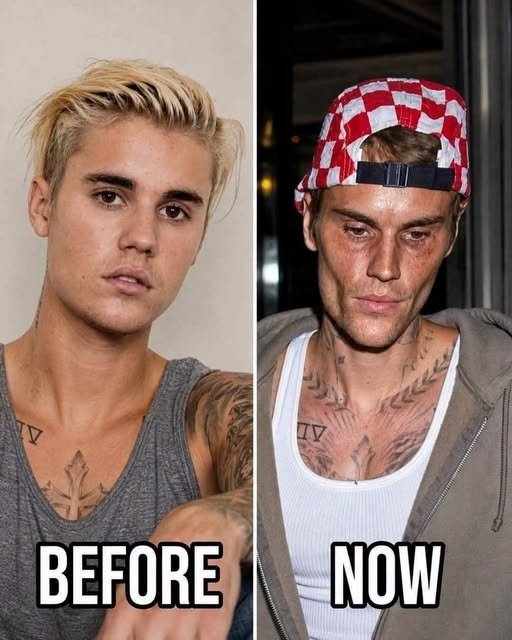 Debunking Viral Myths: The Justin Bieber “Before & Now” Fake Image