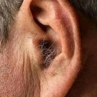 Physiological Reality: Why Ear Hair Grows with Age