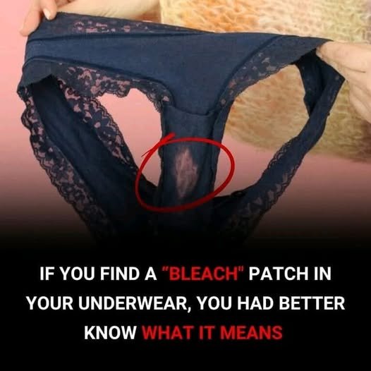 Biological & Chemical Reality: Bleach-Like Discoloration on Underwear