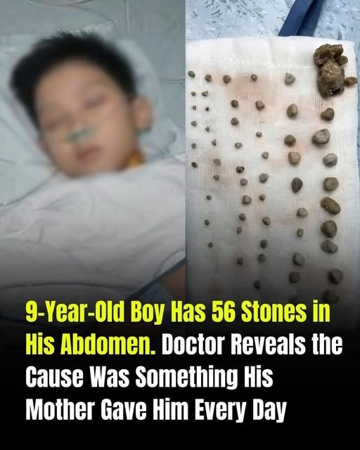 Fact-Checking the “56 Stones” Clickbait Headline