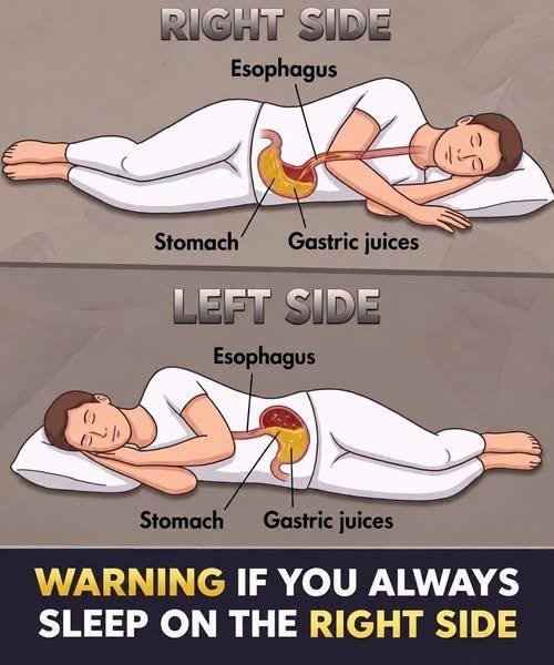 Deconstructing Health Advisory Clickbait: The Left-Side Sleeping Diagram