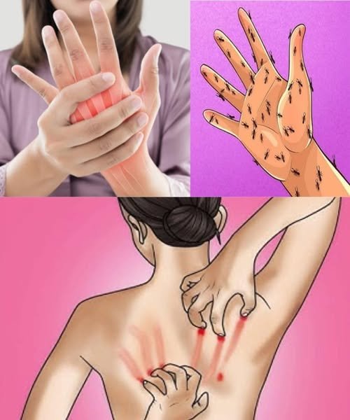 Health Reality: Deconstructing “Toxin/Uric Acid” Clickbait