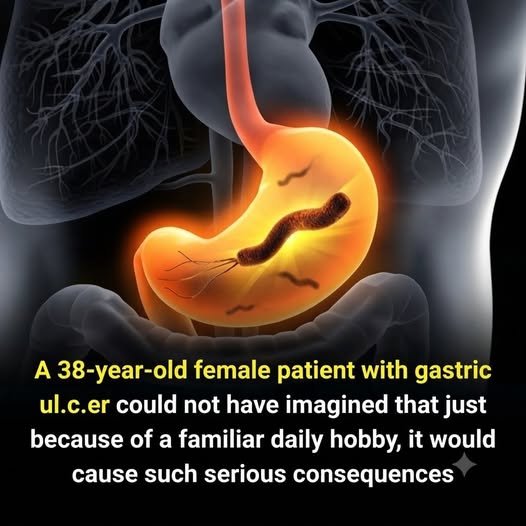 Medical Reality: Causes and Irritants of Stomach Ulcers