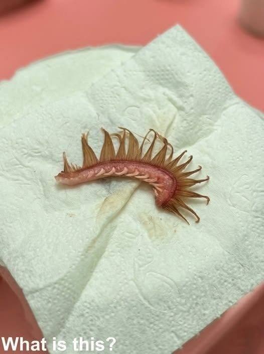 This is a segment of a fish gill arch (part of the fish’s respiratory system).